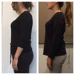 ビフォーアフター