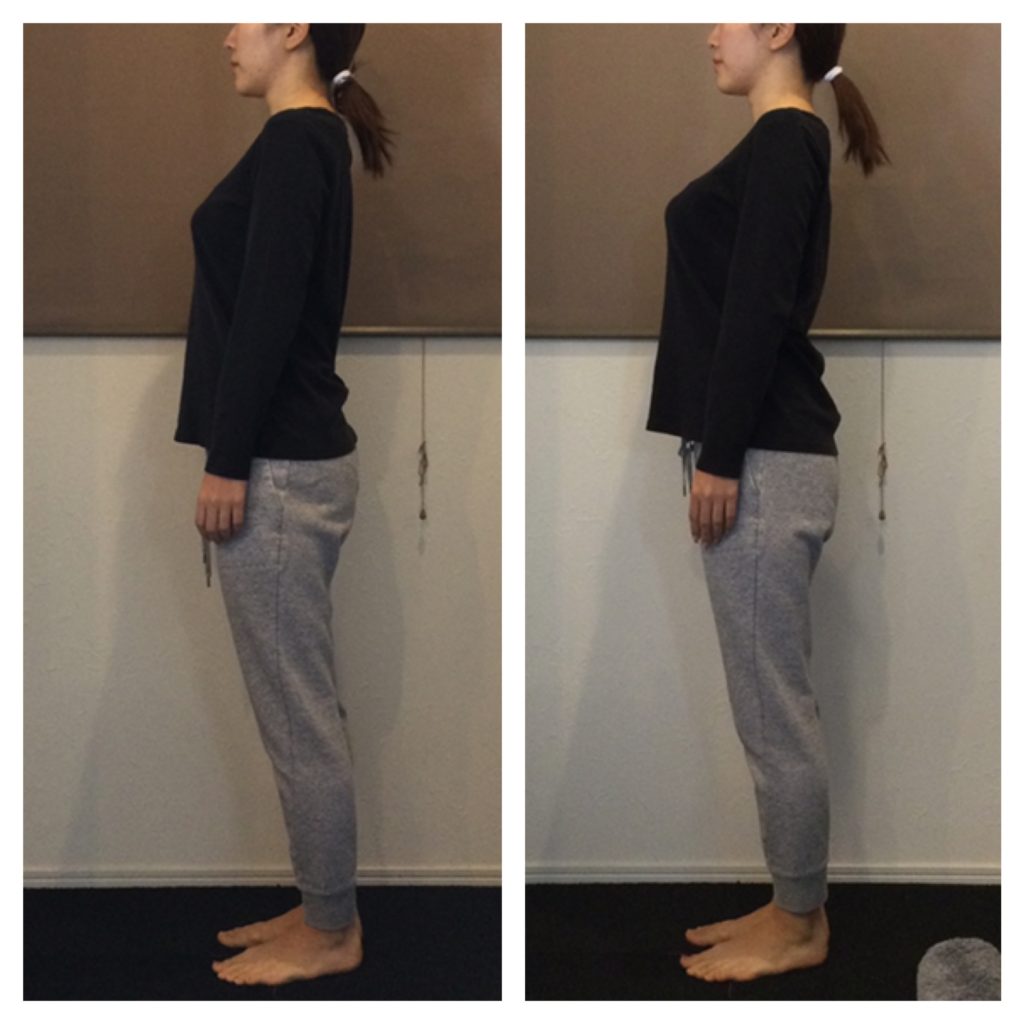 ビフォーアフター