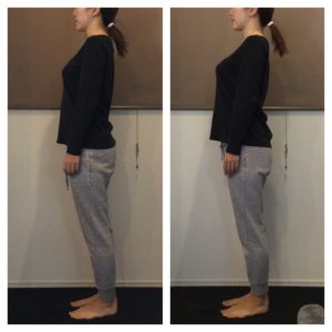 ビフォーアフター