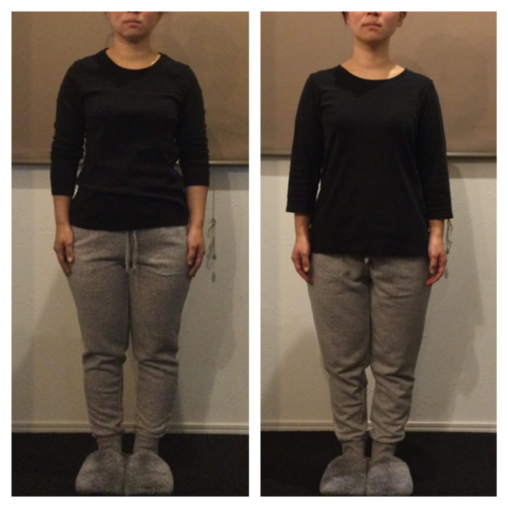 ビフォーアフター