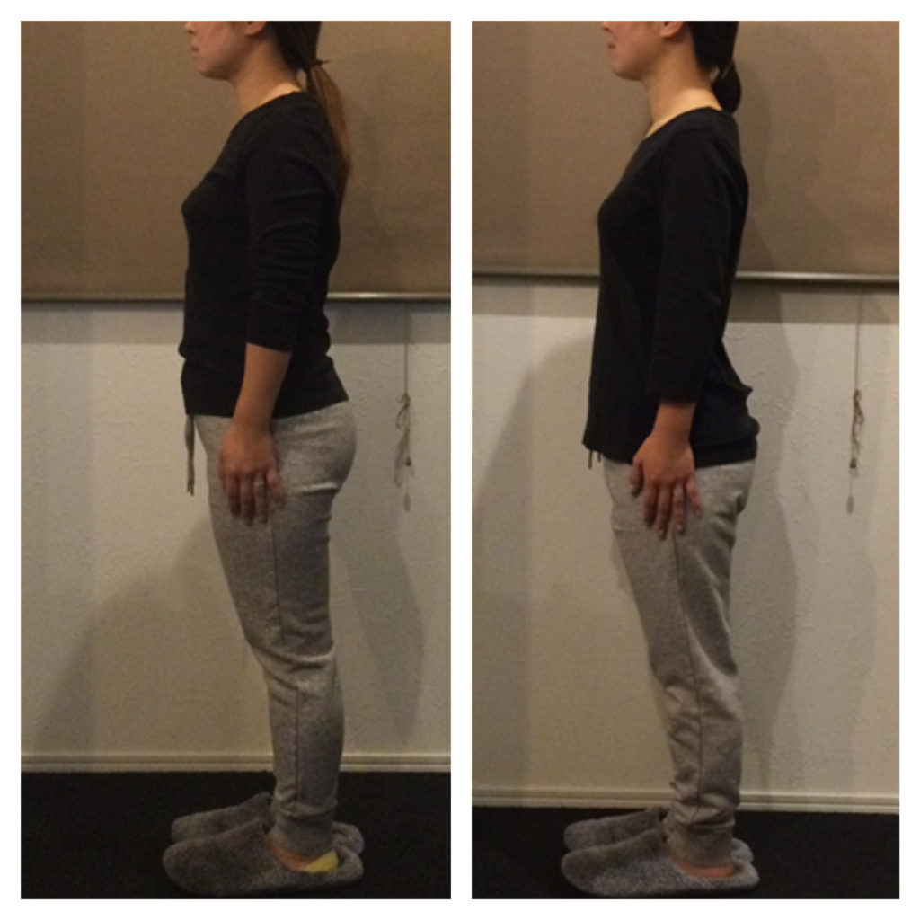 ビフォーアフター